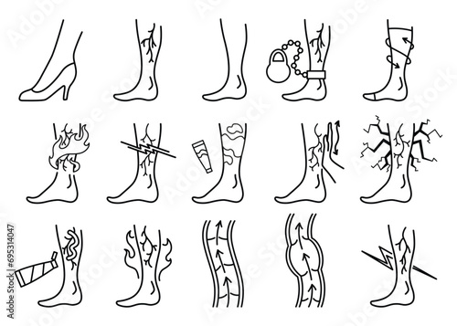 Varicose treatment icons set in coloring style. Violation of circulatory system. Vascular disease diagnostic. Venous insufficiency medical disease. Vector illustration