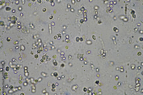 Fotografie Coughing up mucus and phlegm from a chest infection from a virus and bacteria infection, looking at it under the microscope, with cells and microorganisms