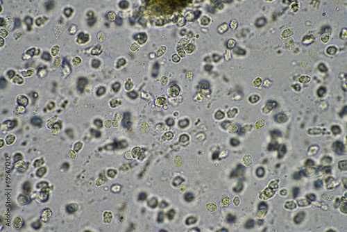 Coughing up mucus and phlegm from a chest infection from a virus and bacteria infection, looking at it under the microscope, with cells and microorganisms. Bacteria and skin cells close up
