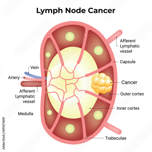 Lymph Node Cancer Science Design Vector Illustration photo