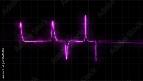 Animated solar neon with heartbeat animation photo