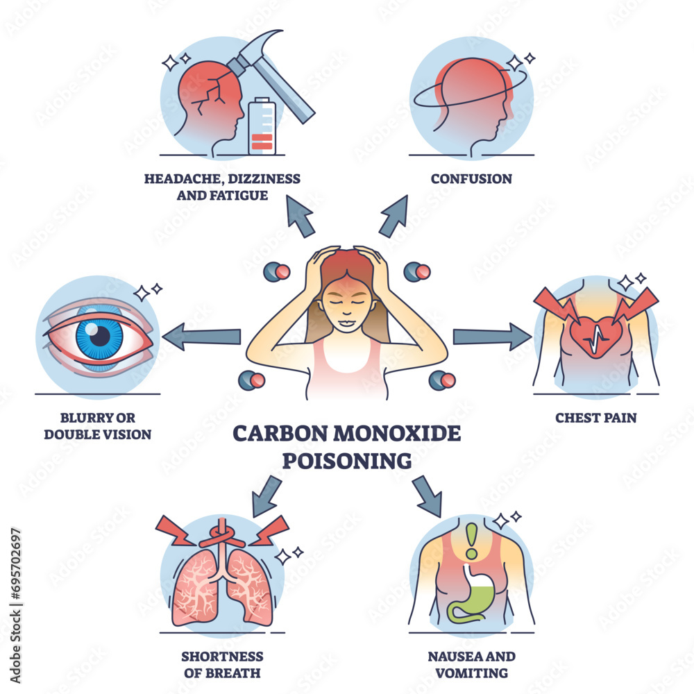Carbon monoxide poisoning symptoms with toxic health issues outline diagram. Labeled educational feelings after dangerous gas exposure vector illustration. Confusion, headache, nausea and fatigue. - obrazy, fototapety, plakaty 