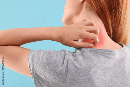 Suffering from allergy. Young woman scratching her neck on light blue background, closeup