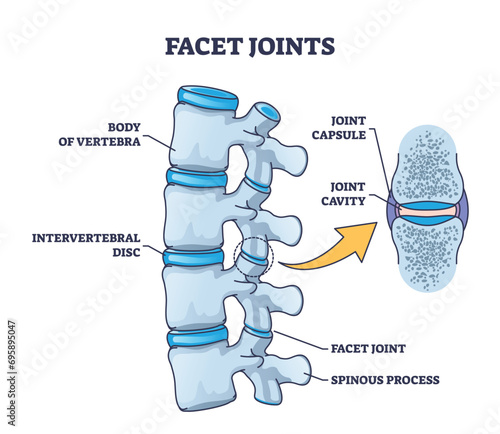 Facet joints anatomy with bone capsule and cavity closeup outline diagram. Labeled educational medical explanation with body of vertebra, intervertebral disc and spinous process vector illustration.