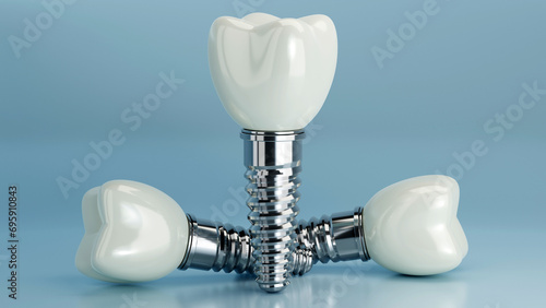 3D rendering of dental implant structure, medical teeth implant, design of dentistry, implant screw, healthcare, dentist and orthodontist treatment, Dental implants surgery concept