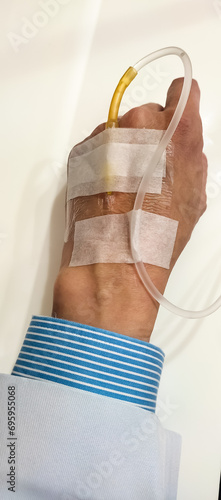Sick doctor's left wrist with intravenous medicine injection. He still tough working despite got sick in hospital office with long sleeve blue shirt and white gown
