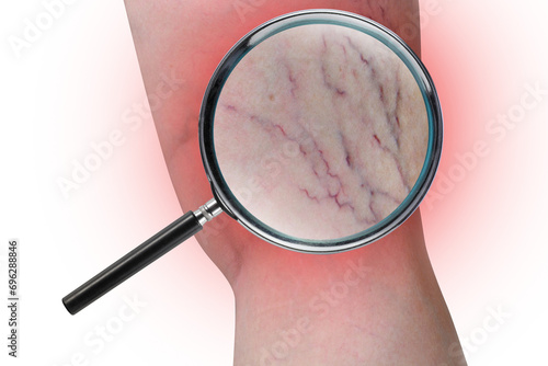 Leg capillary magnifier PNG transparent