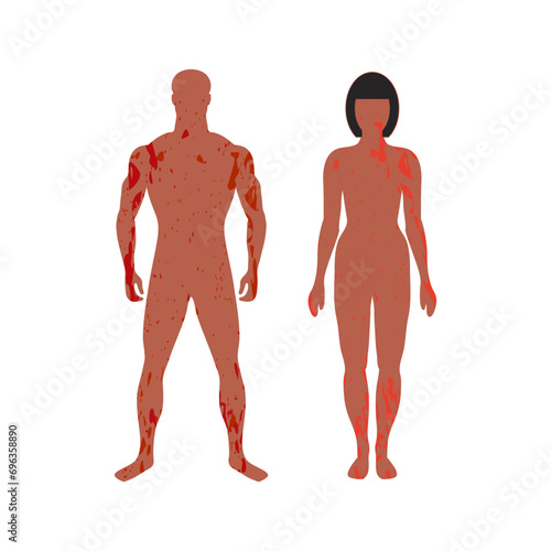 Standing adult man and woman with painful rash