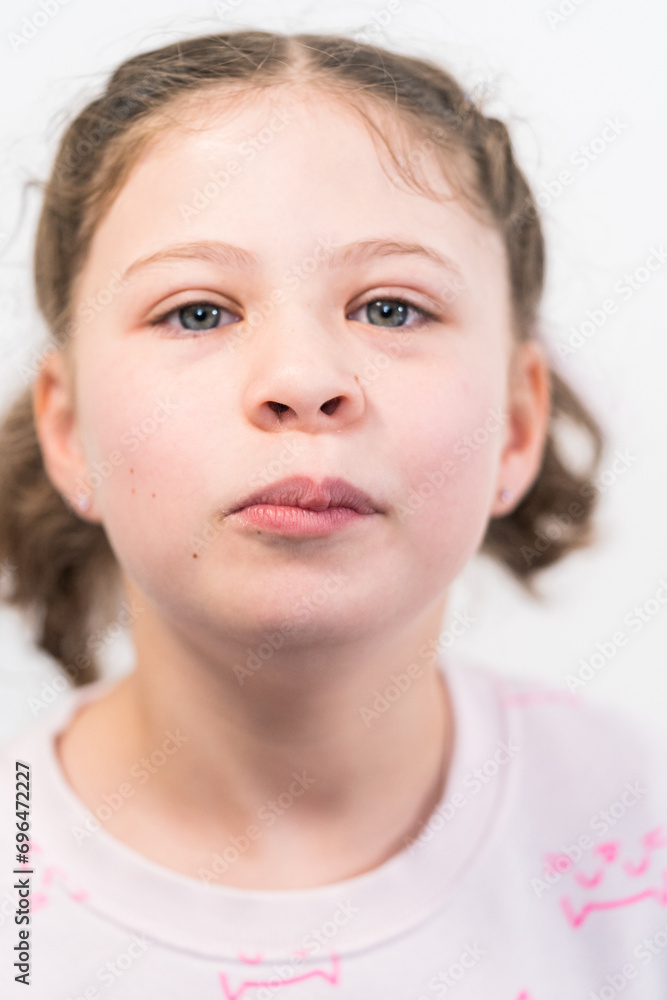 Little girl with rainbow braces Little girl with rainbow braces