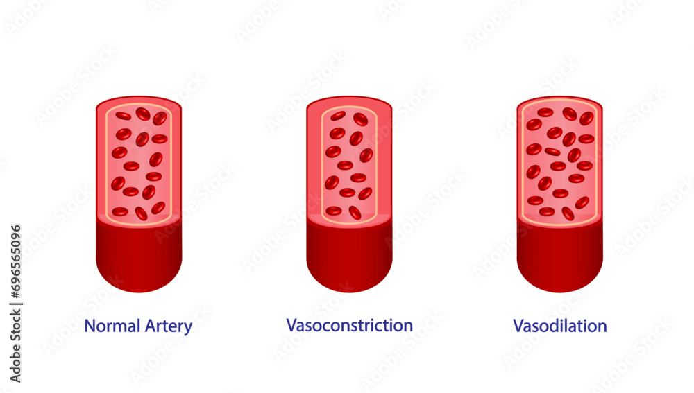 Arterial Vasoconstriction And Vasodilation Cross Section Of Arteries Comparison Of Normal