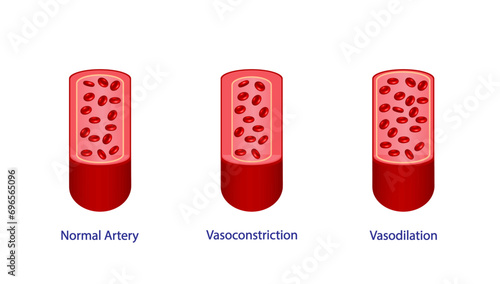 Arterial vasoconstriction and vasodilation. Cross section of arteries. Comparison of normal, constricted, and dilated blood vessels. Scientific Diagram. Vector illustration.