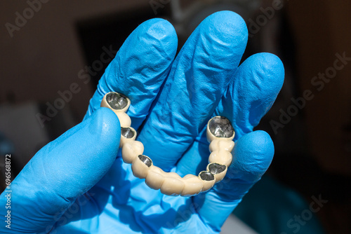 The dentist holds a ceramic, zirconium, bridge-shaped, non-removable dental prosthesis in his hand. Dental bridge.	