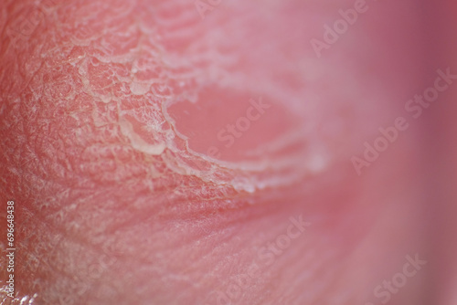 Macro texture of dried foot skin 