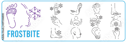 Frostbite. Symptoms, Line icons set. Vector signs for web graphics