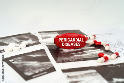 Φωτογραφία On the ultrasound pictures there are pills and a pen with the inscription - peri