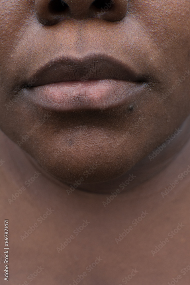Obraz premium Brown skin with dark spots, hyperpigmentation on brown skin, african american woman with skin blemishes, imperfect skin