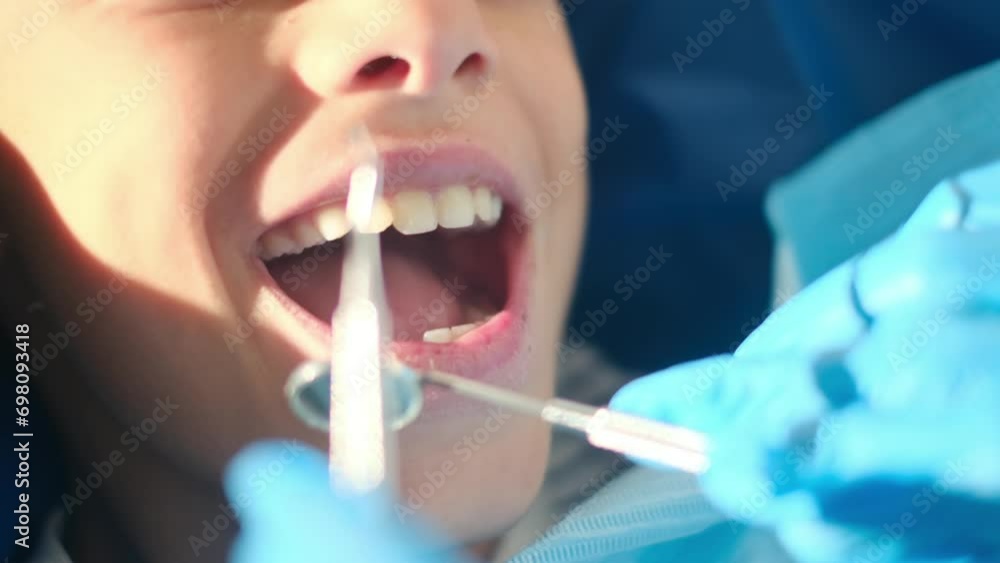 Using a dental probe and angled mirror, a compassionate female dentist evaluates the status of tooth decay in a young patient. Using a dental probe and angled mirror, a compassionate female dentist evaluates the status of tooth decay in a young patient.