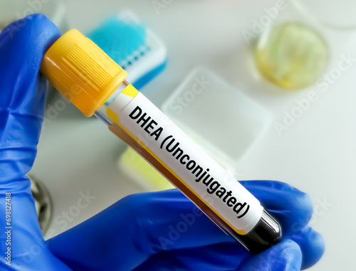 Test Tube with blood sample for DHEA (Unconjugated) hormone test. dehydroepiandrosterone. photo