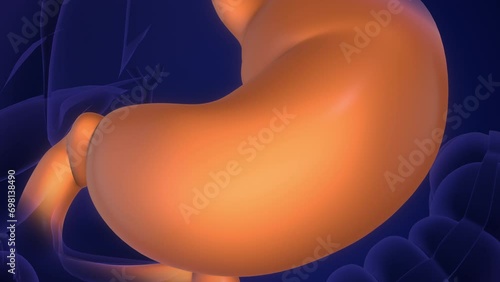The stomach is affected by Helicobacter pylori bacteria photo