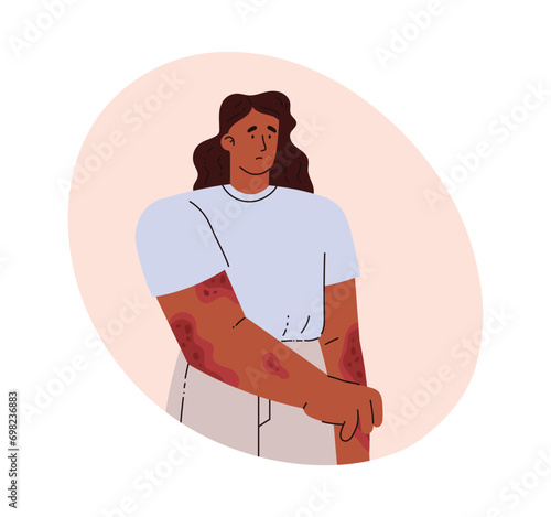 Woman with skin problem. Vector illustration in flat style on white.