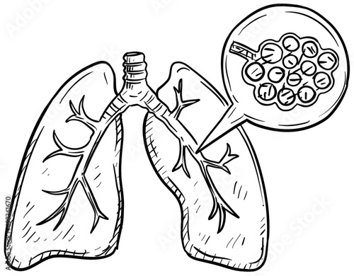 bronchitis handdrawn illustration