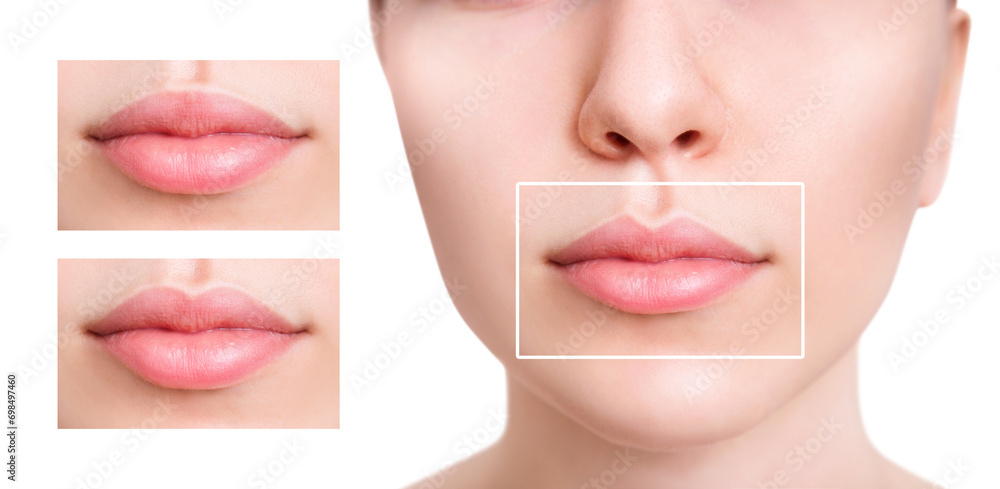 Young woman near set of different lips shapes. - obrazy, fototapety, plakaty 