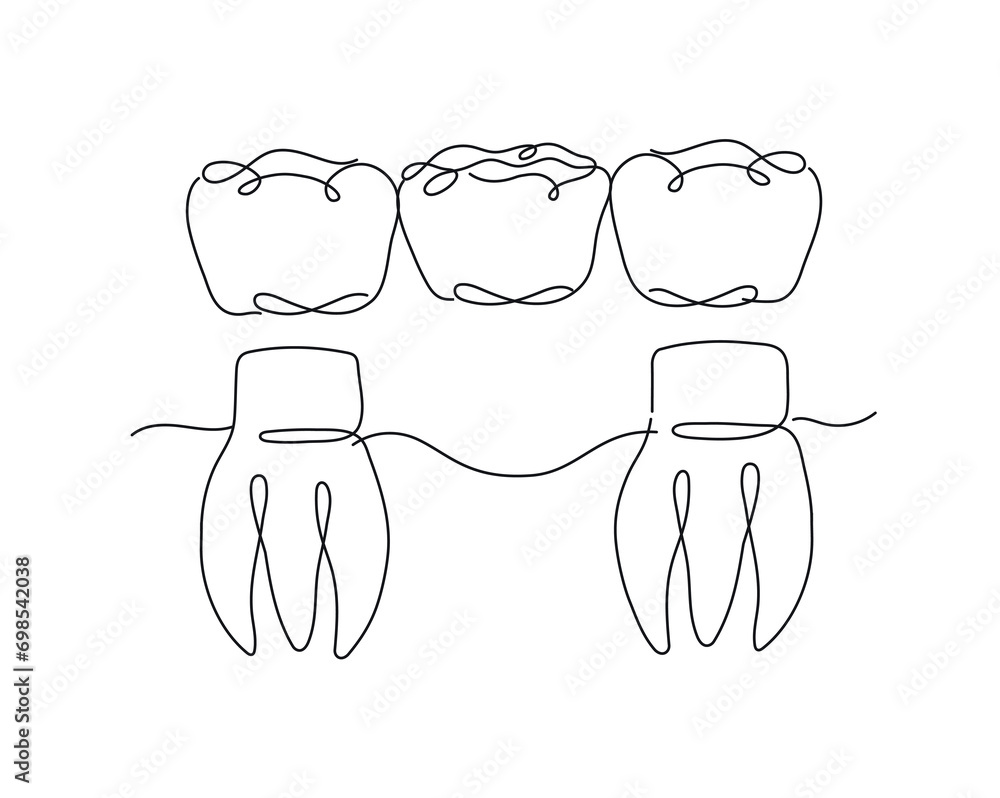 Teeth with crown bridge illustration drawing in flat line style on white background