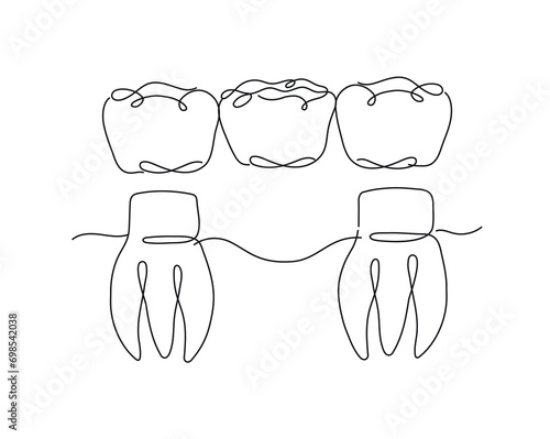 Obraz na płótnie Teeth with crown bridge illustration drawing in flat line style on white background w salonie
