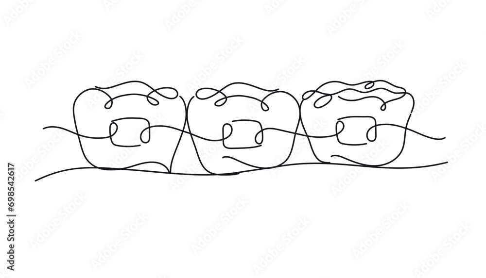 Teeth braces illustration drawing in flat line style on white color background