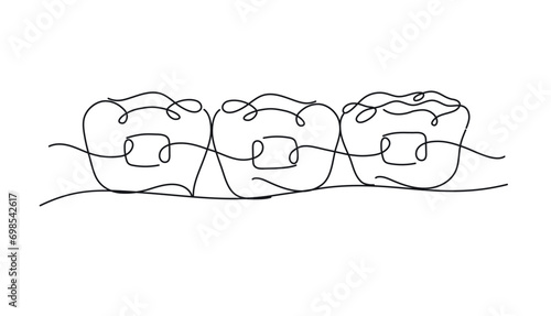 Obraz na płótnie Teeth braces illustration drawing in flat line style on white color background w salonie
