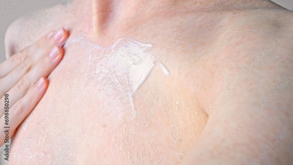 Fototapeta premium Using cream to moisturize dry problem skin in chest area close up side view medicine and healthcare treating dermatitis and dry skin by cream, concept of moisturizing skin with cream