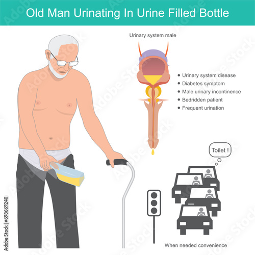 Old man urinating in urine filled bottle. old man urinating in urine filled bottle because he had inconvenient to use the bathroom..