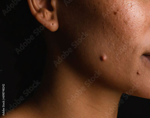 Generative AI illustration of macro shot of a person's profile showing the natural texture of skin with blemishes photo
