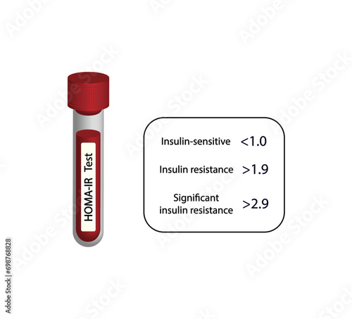 HOMA-IR (Homeostatic Model Assessment for Insulin Resistance).Low, Borderline and High diabetes risk. Insulin resistance. Vector illustration.