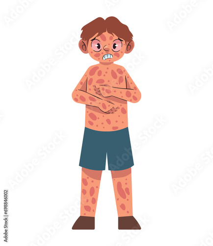 kawasaki disease boy