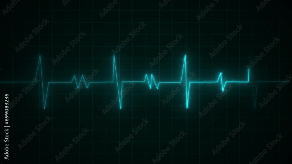 Digital cyan color technology heart beat line background animation Digital cyan color technology heart beat line background animation