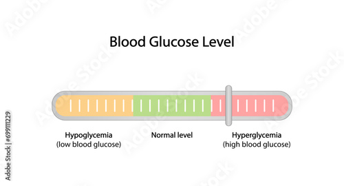 Blood Glucose Levels. Normal level, hypoglycemia (low blood sugar), hyperglycemia (high blood sugar), sugar test. vector diagram