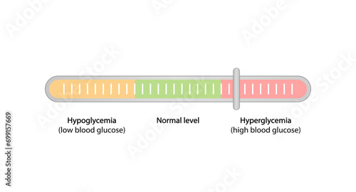 	
Blood Glucose Levels. Normal level, hypoglycemia (low blood sugar), hyperglycemia (high blood sugar), sugar test. vector diagram