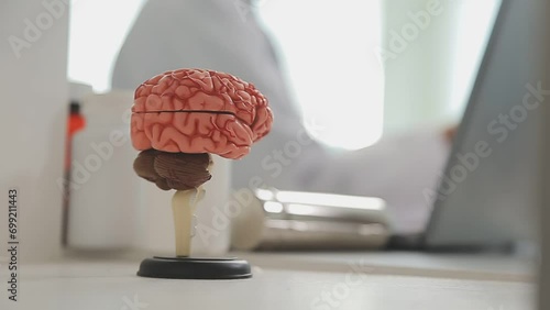 .Human head anatomical model on doctor's table over background neurologist analyzing results of MRI scan of patient brain at medical clinic. Diseases of brain, nerves and nervous system photo