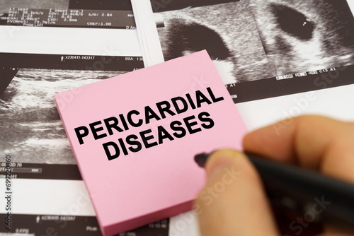 Tableau sur toile On the ultrasound pictures there are stickers that say - pericardial diseases