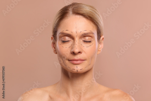 Portrait of beautiful woman with markings before cosmetic surgery on light brown background