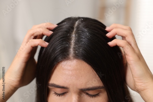 Woman examining her hair and scalp indoors, closeup. Dandruff problem
