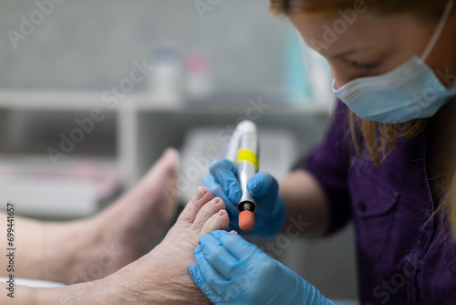 Wallpaper Mural The podiatrist uses an electric nail cutter to remove excess hardened skin from the client's feet. Torontodigital.ca