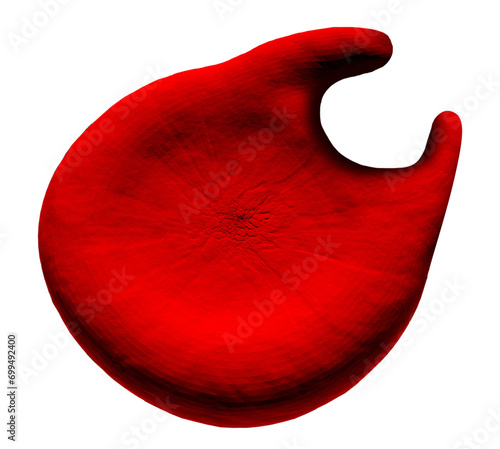Horn cell abnormal red blood cell, illustration photo