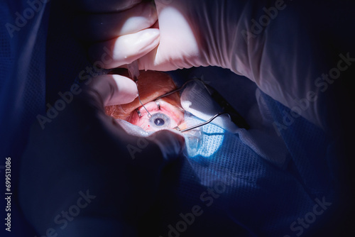 Foto Doctor use equipment for ophthalmology operation deleted cataract or glaucoma, patient under sterile cover
