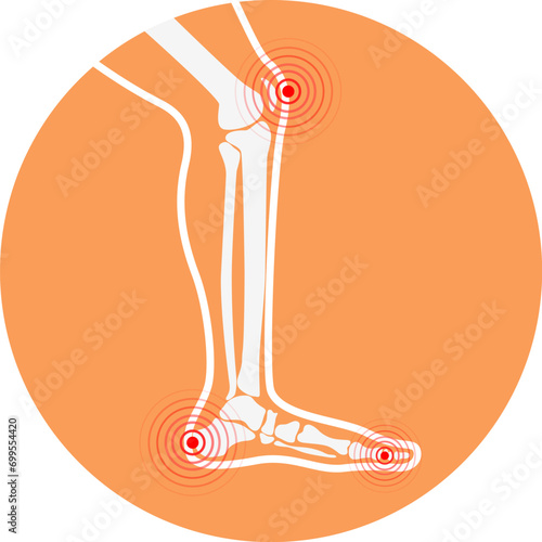 Human leg pain zones. Design elements for infographic. Vector illustration.