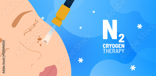 Cryotherapy process vector illustration. Removing age spots on woman's face. Precision cryoablation. Liquid nitrogen treatment. Targeted frozen surgery for skin health and condition.