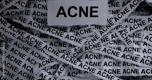 Strips of newspaper with the words Acne typed on them. Black and white. Close up. photo
