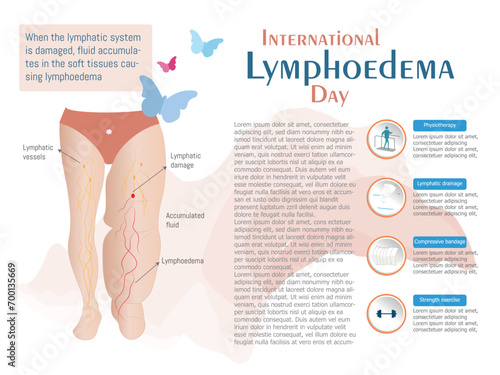 Leg with lymphedema and some of the treatments for improvement, along with space for text.