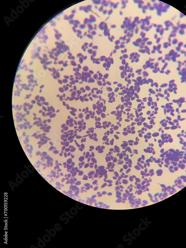 A smear of yeasts Wickerhamomyces anomalus under a microscope is stained with gentian violet or Gram photo